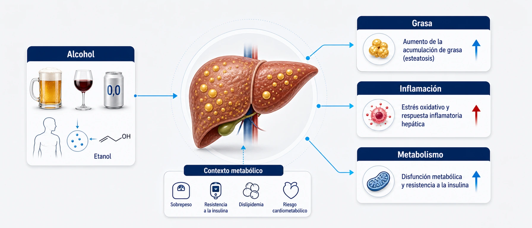Infografía clínica sobre alcohol grasa inflamación y metabolismo en hígado graso