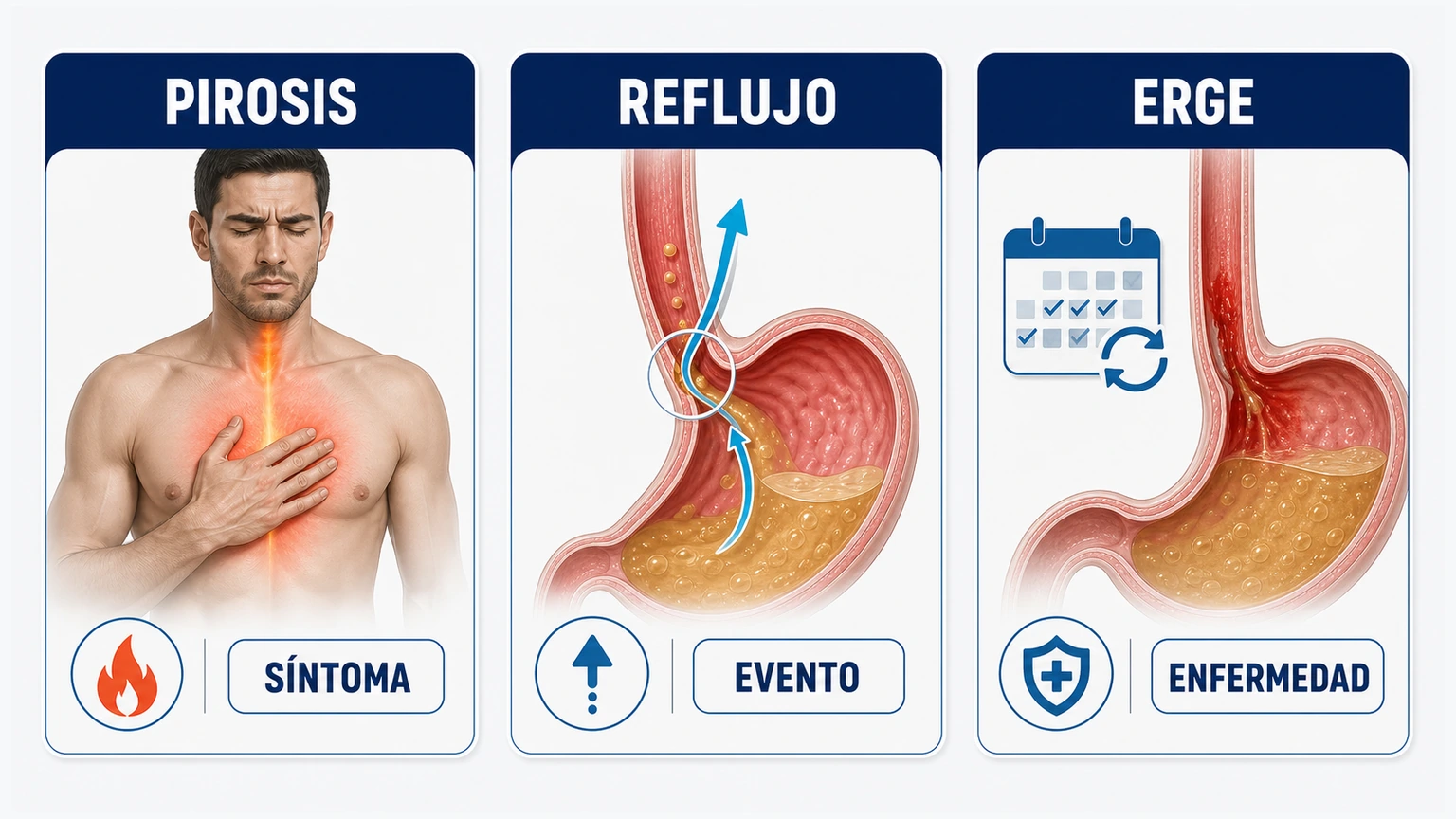 Comparativa entre pirosis reflujo y ERGE como síntoma evento y enfermedad