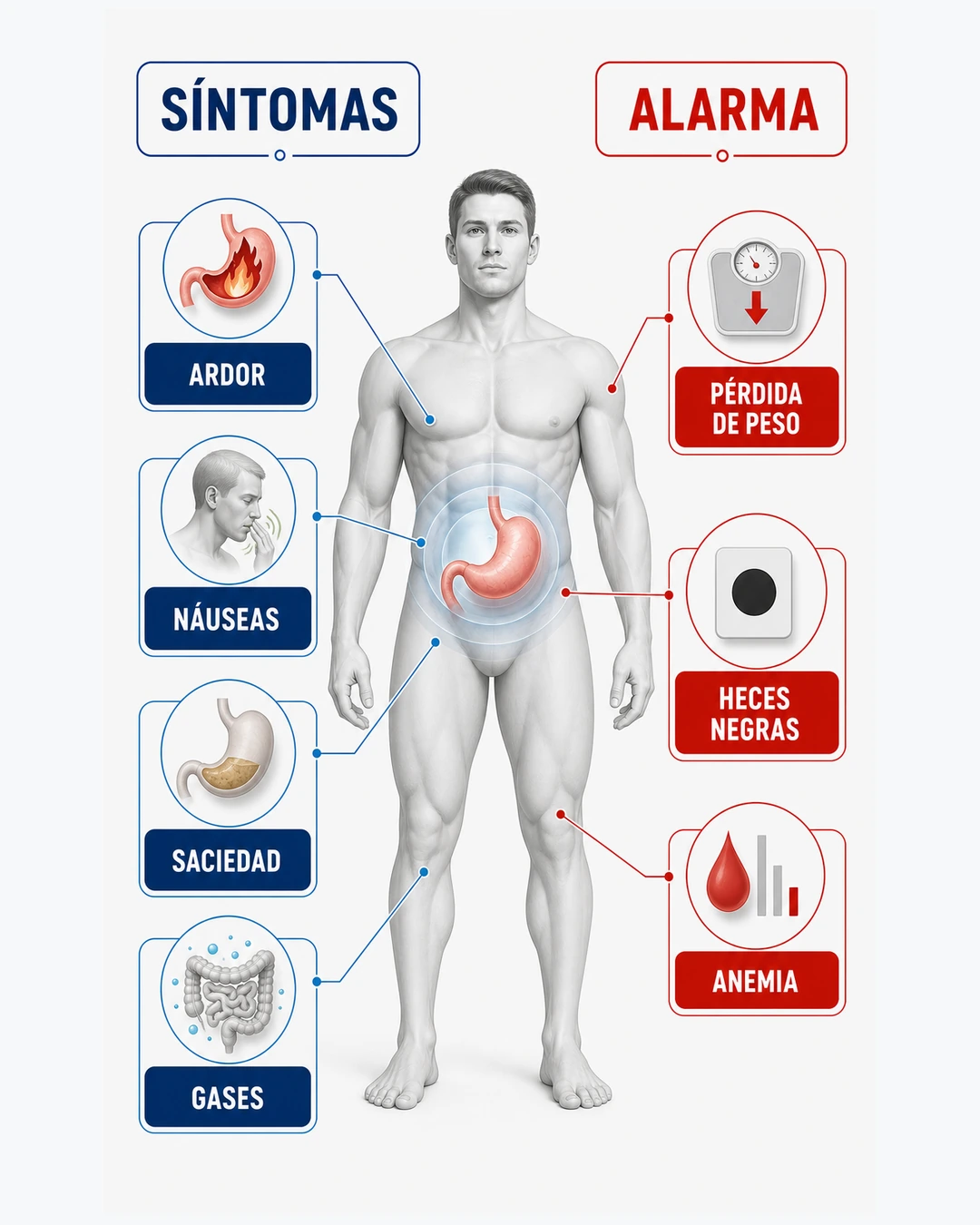 Ilustración de síntomas de gastritis y signos de alarma como pérdida de peso heces negras y anemia