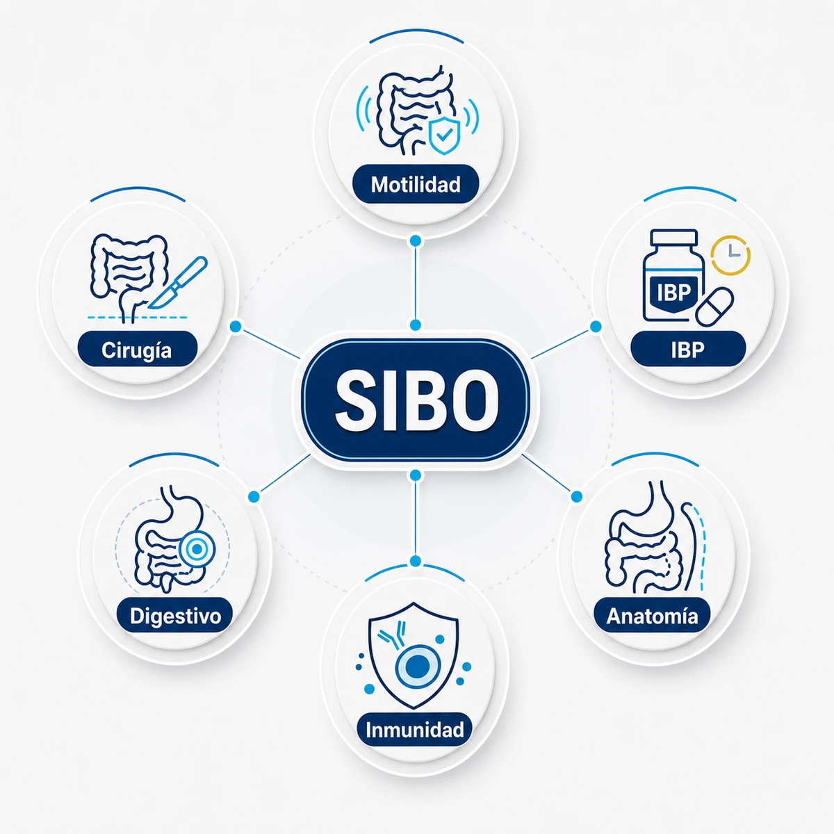 Mapa conceptual de causas del SIBO con motilidad cirugía IBP digestivo anatomía e inmunidad