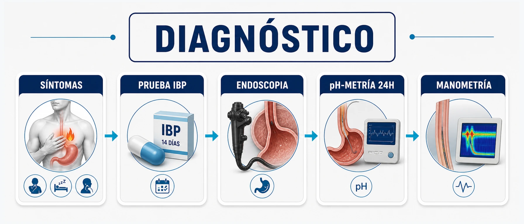 Flujo diagnóstico del reflujo con síntomas prueba IBP endoscopia pH metría y manometría