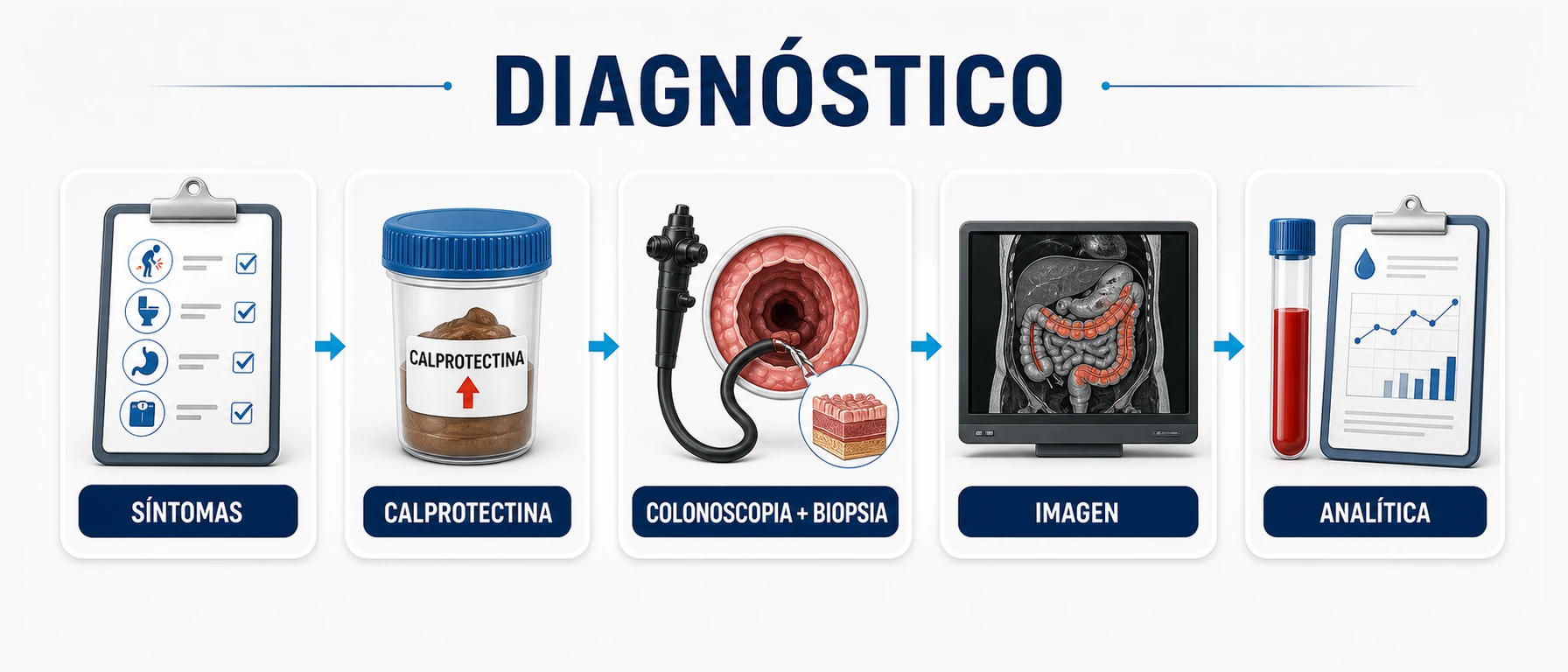 Flujo diagnóstico de enfermedad de Crohn con síntomas calprotectina colonoscopia biopsia imagen y analítica