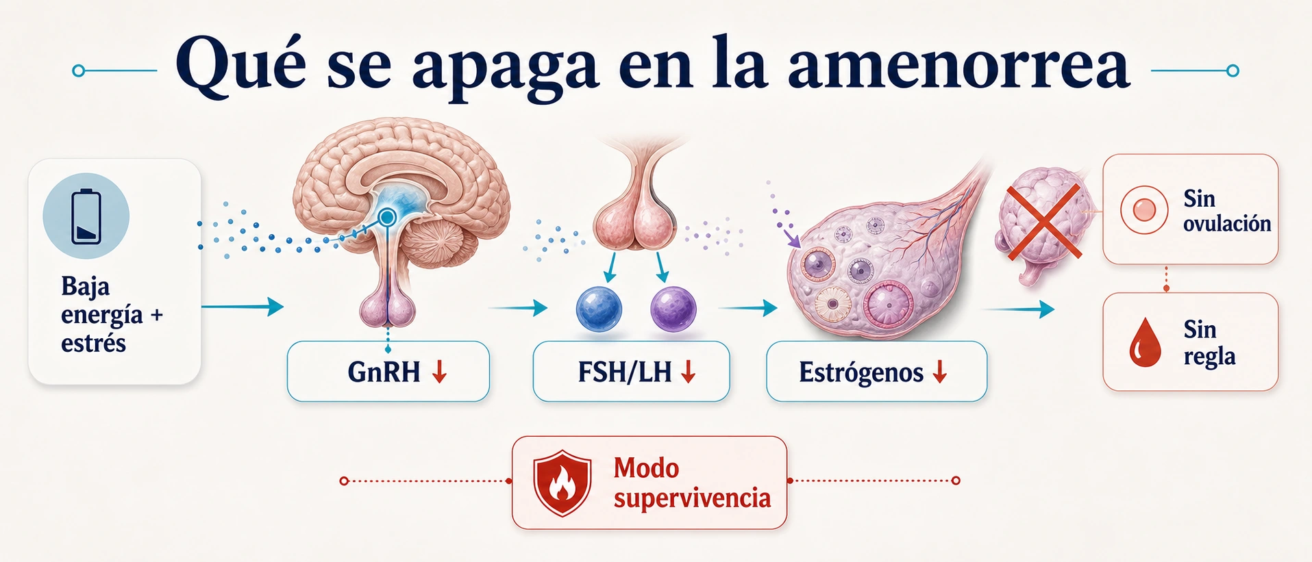 Infografía de la amenorrea hipotalámica con baja GnRH FSH LH estrógenos bajos sin ovulación y sin regla