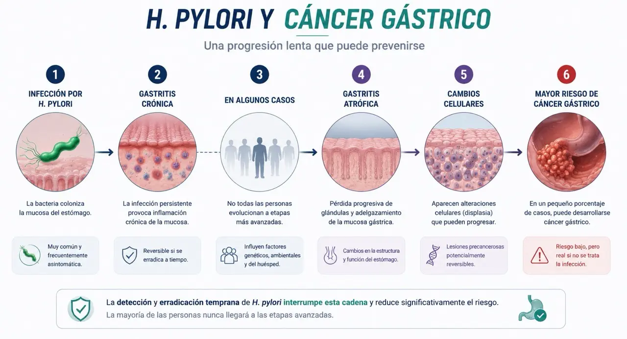 Linea temporal fisiopatologica que muestra Helicobacter pylori, gastritis cronica, gastritis atrofica, cambios celulares y mayor riesgo de cancer gastrico en algunos casos