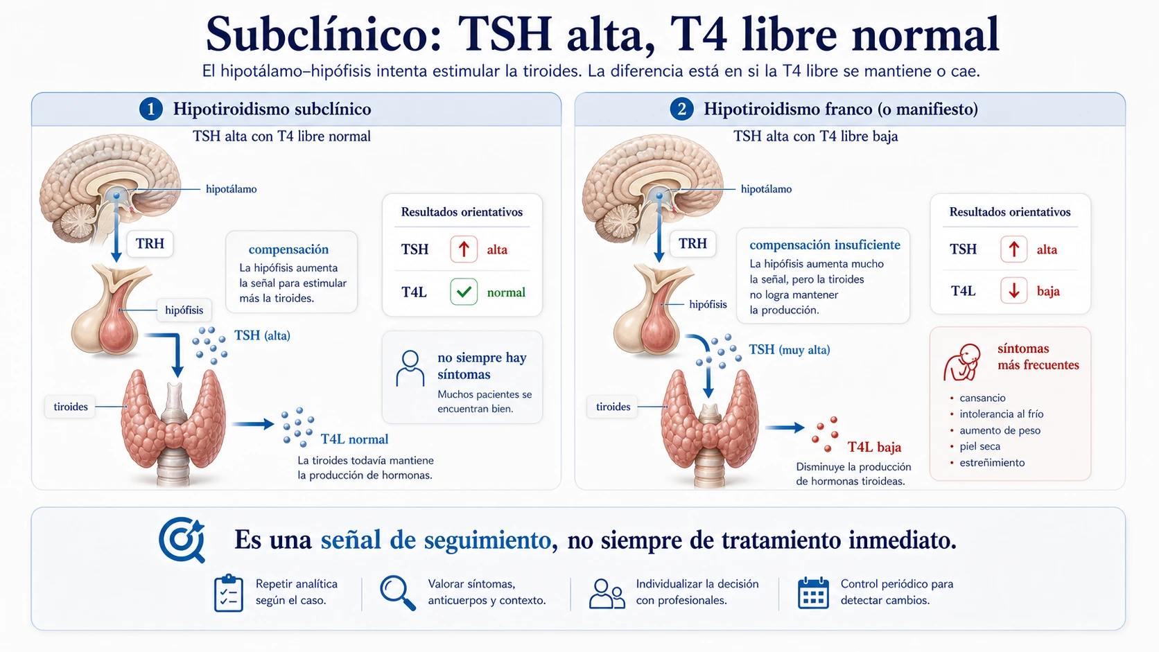 Hipotiroidismo subclinico con TSH alta T4 libre normal y comparacion con hipotiroidismo franco