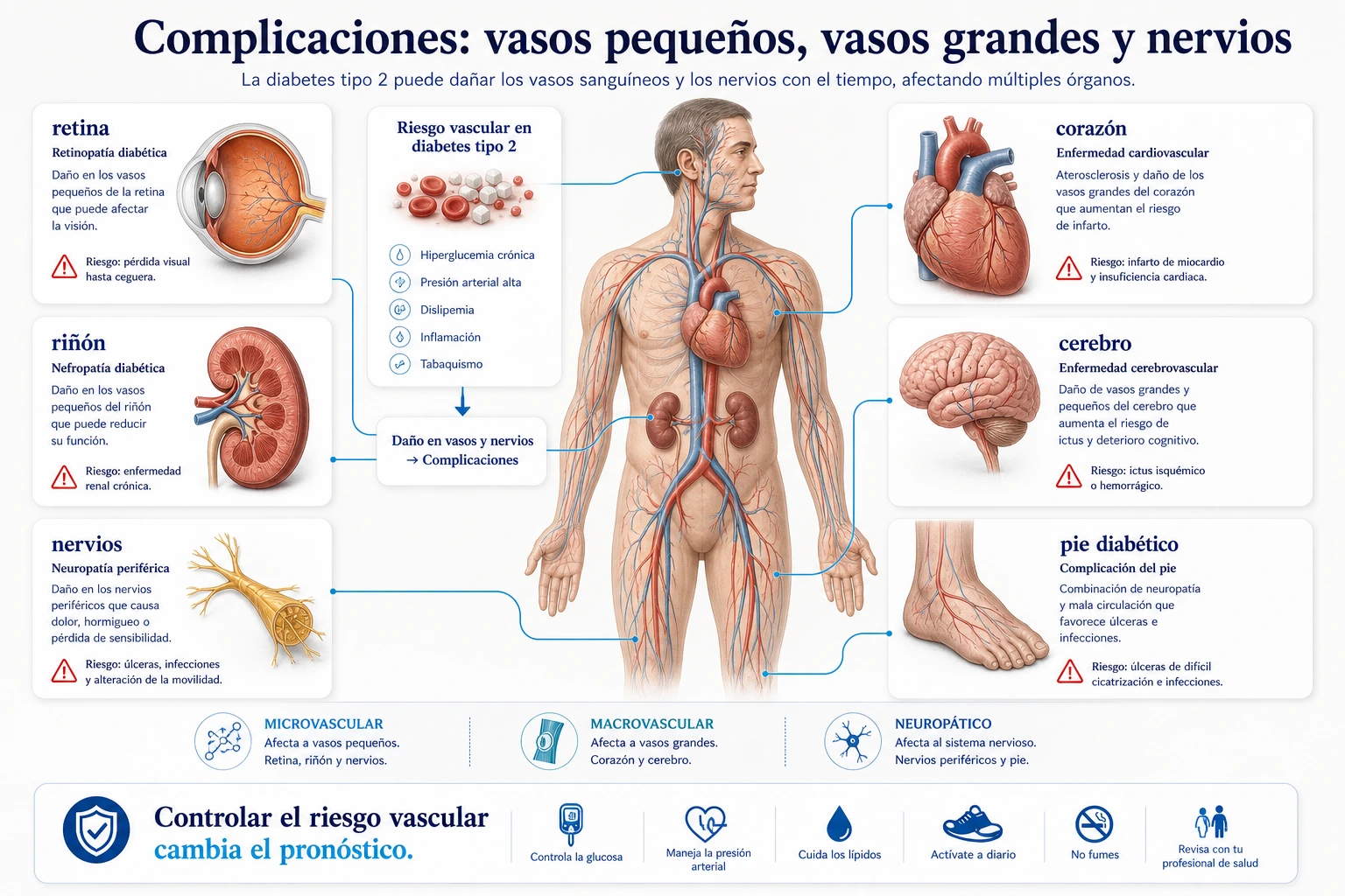 Complicaciones de diabetes tipo 2 en retina riñon nervios corazon cerebro y pie diabetico por daño vascular y neuropatico